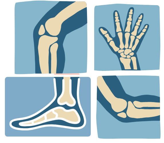 4 types pain