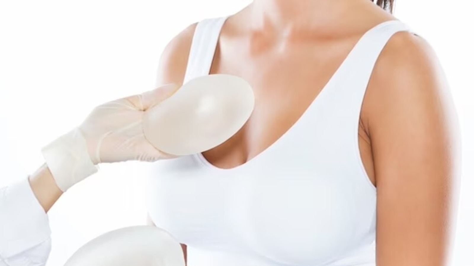 Breast implants