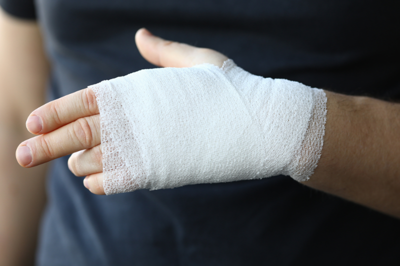 Hand surgery