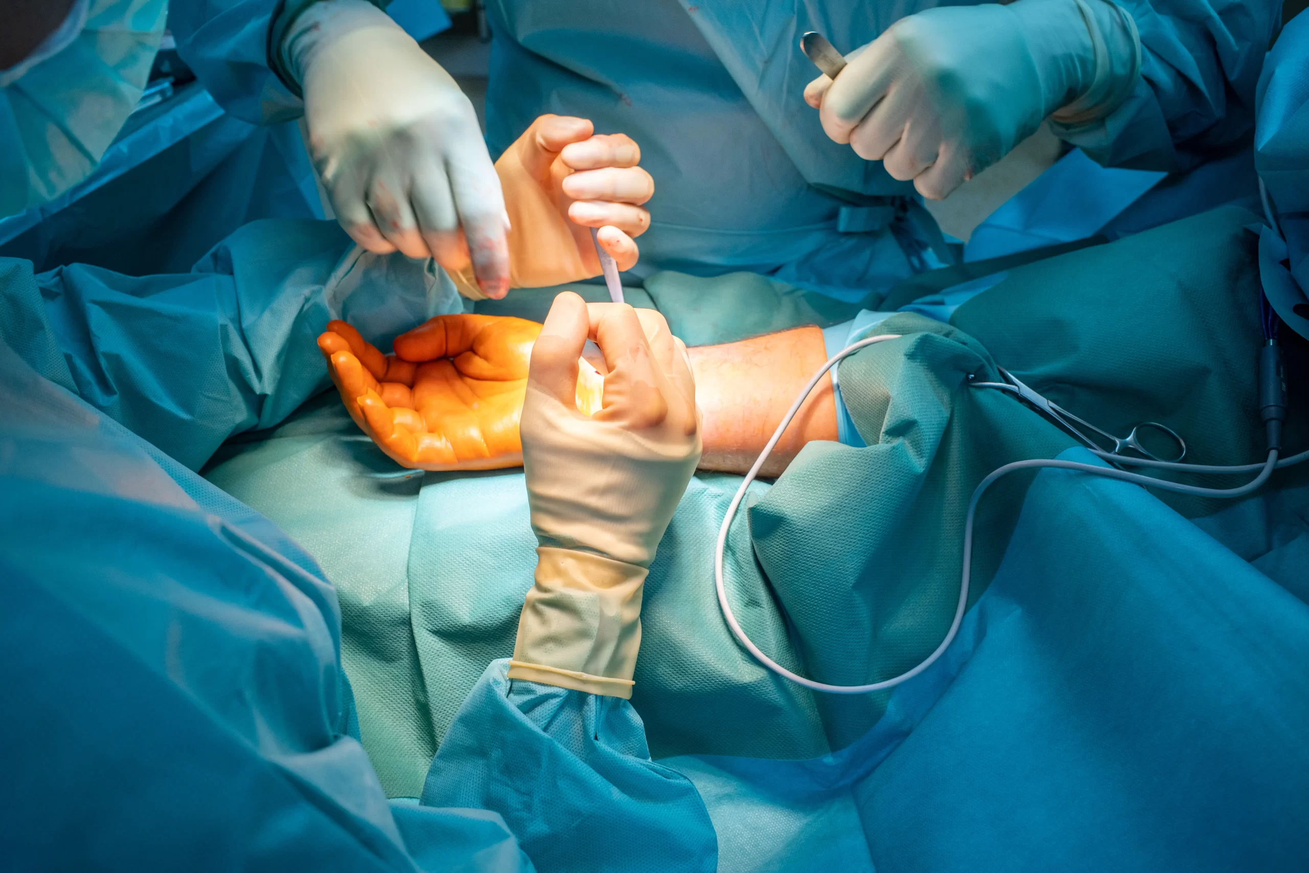 Hand surgery
