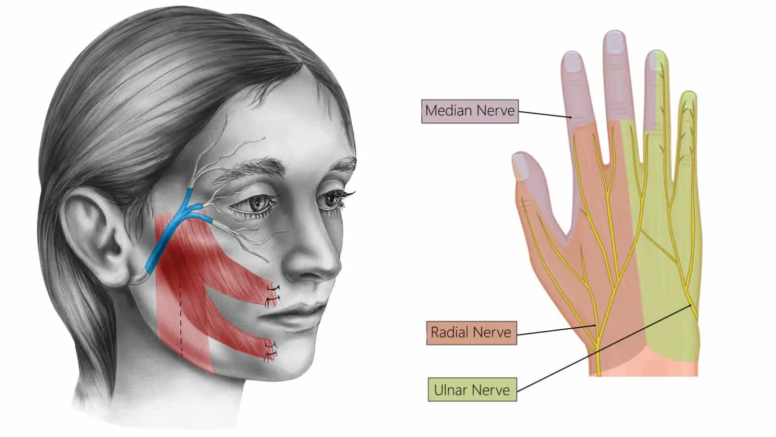 Nerve injury