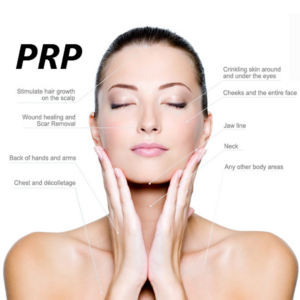 PRP Treatment