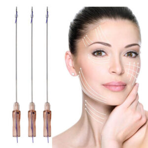 Thread lift treatment2