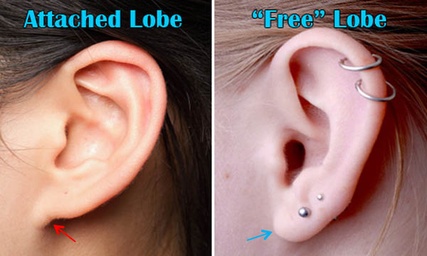 ear-lobe repair