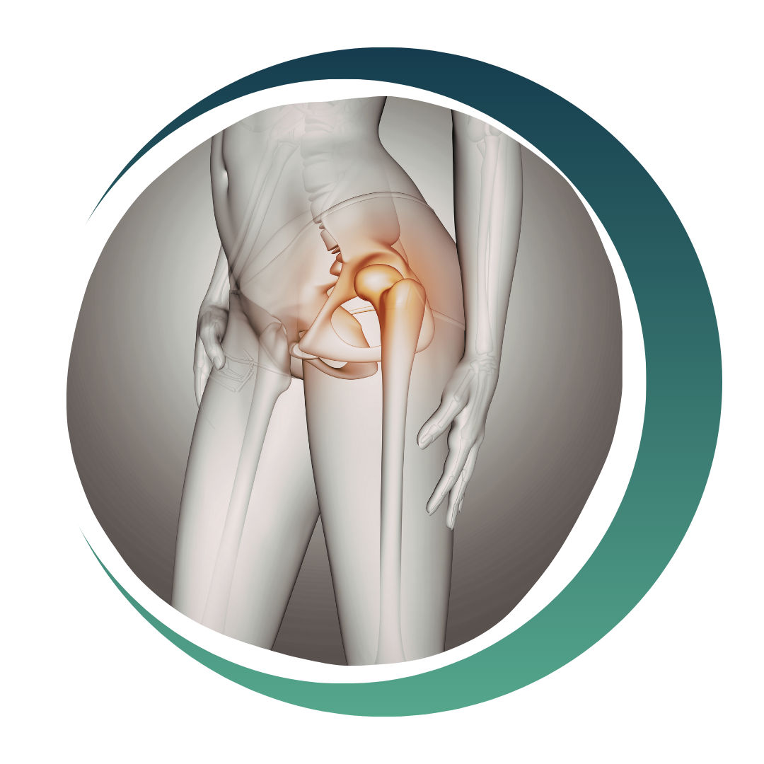 Joint Replacement