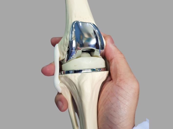 Knee Replacement Surgery