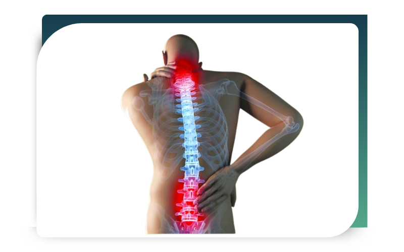 pain manage