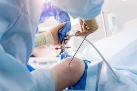 Arthroscopy Surgeon In Nagpur