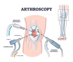 Best Arthroscopy Specialist Doctor In Gondia