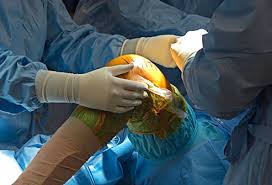 Best Knee Ligament Surgeon In Balaghat