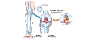 Best Knee Ligament Surgeon In Chhindwara