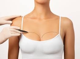 Breast Augmentation in Durg