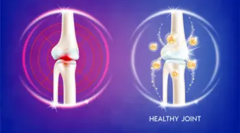 Enhance joint function outcomes