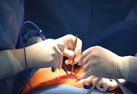 Infection Control Surgery in Nagpur