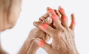 Joint Pain Treatment In Shivpuri