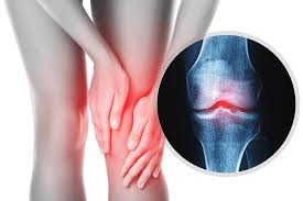 Joint Pain Treatment in Mohla‑Manpur‑Ambagarh Chowki
