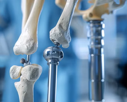 Joint replacement service surgeon