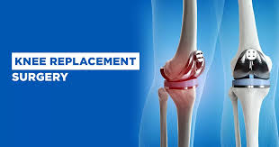 Knee Replacement Surgery In Jabalpur