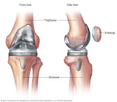 Knee Replacement Surgery in Balod
