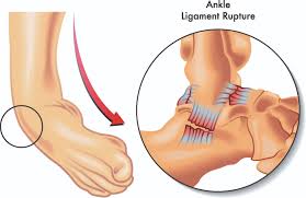 Ligament and Tendon Repair in Nagpur