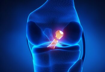 Ligament tear care