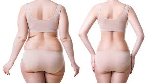 Liposuction In Chhindwara