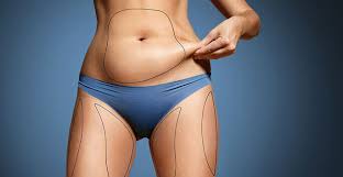 Liposuction In Sagar