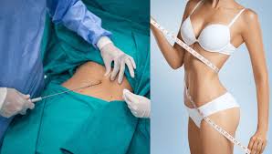 Liposuction in Baloda Bazar-Bhatapara