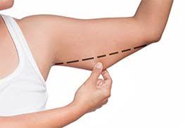 Liposuction in Janjgir-Champa