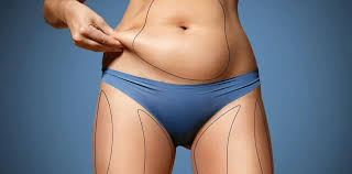 Liposuction in Mohla‑Manpur‑Ambagarh Chowki