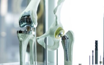 Long lasting joint implants