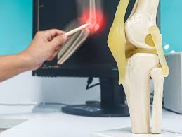 Orthopedic Surgeon in Mahasamund