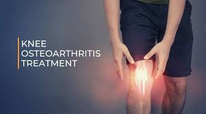 Osteoarthritis Treatment In Nagpur