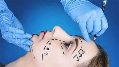 Reconstructive Plastic Surgery