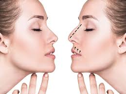 Rhinoplasty In Jabalpur