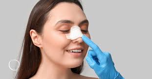 Rhinoplasty in Bemetara