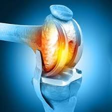 Robotic Hip Replacement in Bilaspur