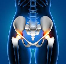 Robotic Hip Replacement in Gaurela-Pendra-Marwahi