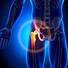 Robotic Hip Replacement in Jashpur