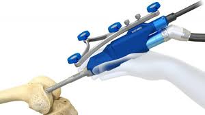 Robotic Joint Replacement In Ujjain