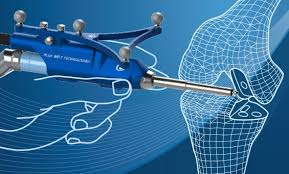 Robotic Joint Replacement in Mahasamund