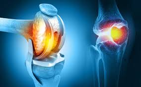 Robotic Knee Replacement in Bastar