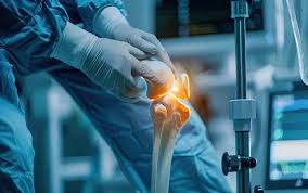 Robotic Knee Replacement in Manendragarh-Chirmiri-Bharatpur