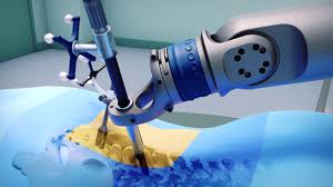 Robotic Orthopedic Surgery In Gwalior