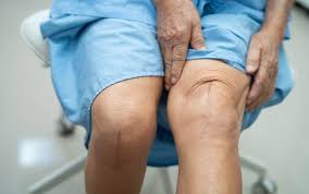 Robotic knee replacement in Gwalior