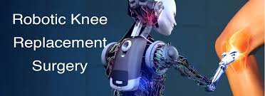 Robotic knee replacement in Ujjain