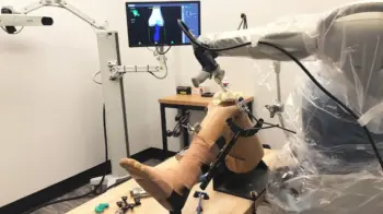 Robotic knee replacement in wardha