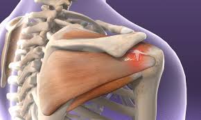 Rotator Cuff Surgeon in Balaghat