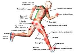 Sports Injury Treatment in Korba