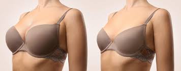 Breast Augmentation In Shajapur